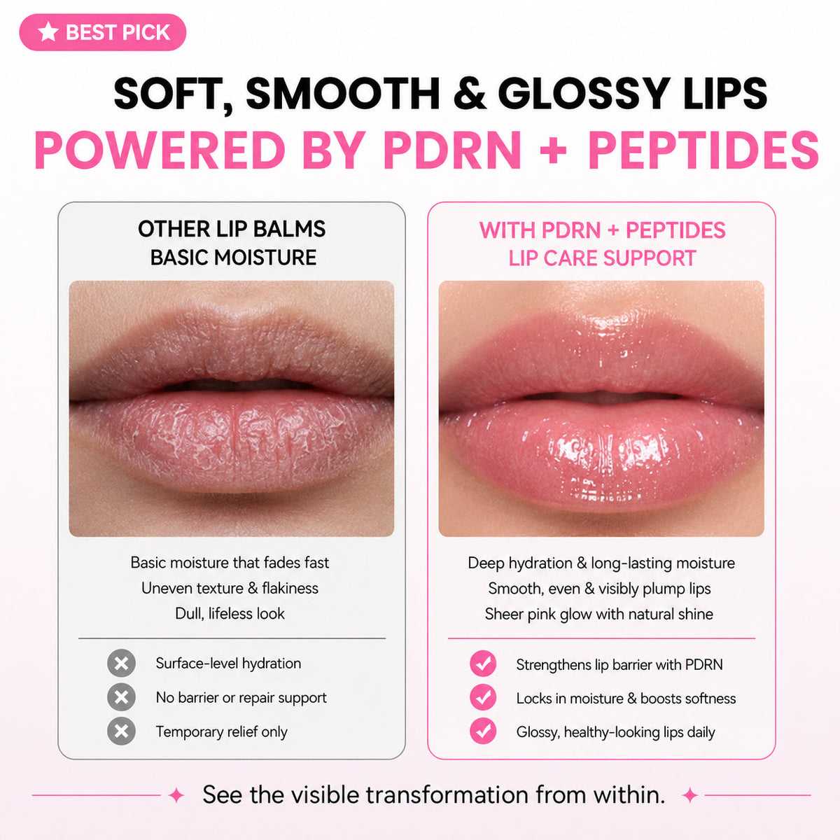 PDRN Peptide Glossy Lip Balm